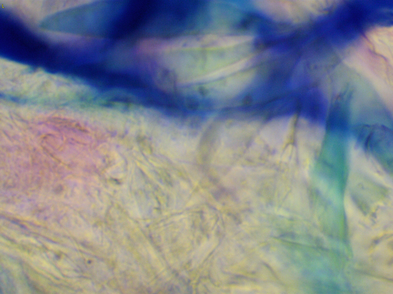 23207 177264 Into CNS 000006