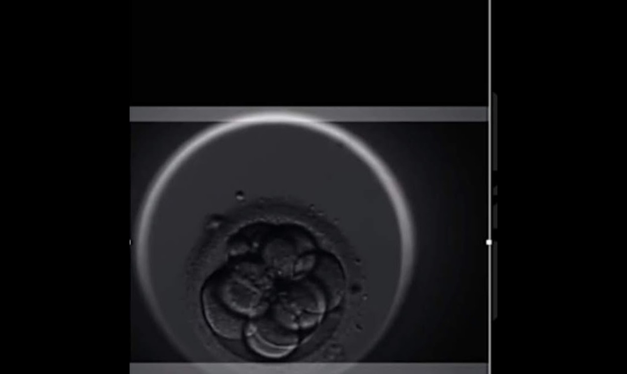 Screenshot_20230721_155256_Photos