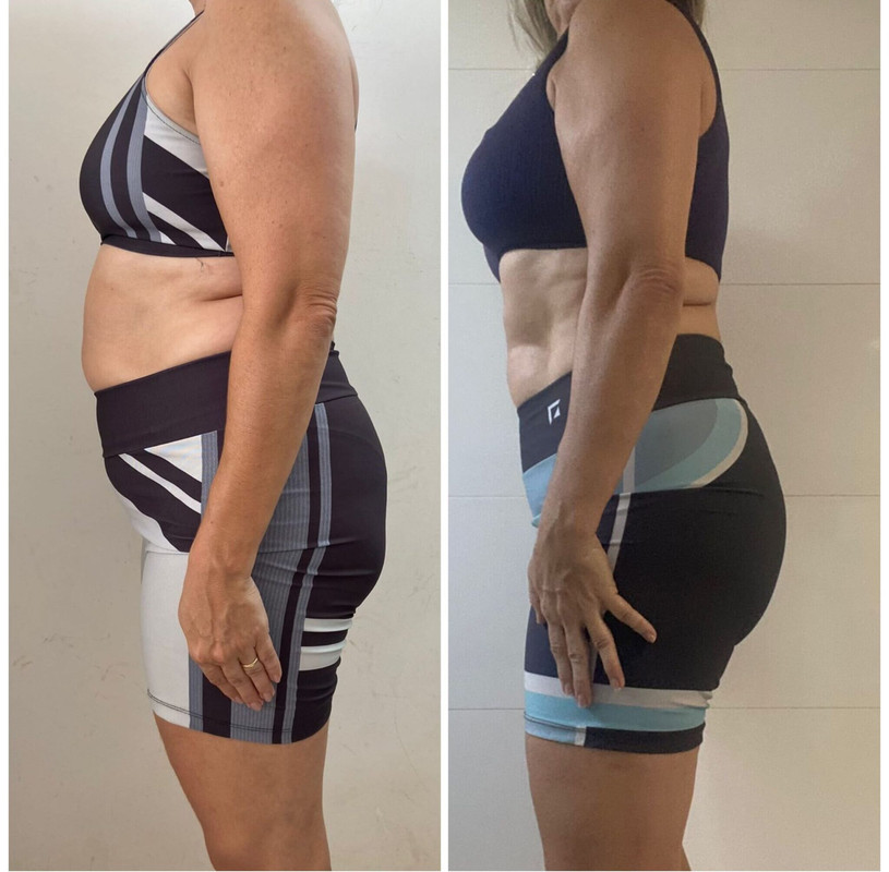 [Resultado antes y después 2]