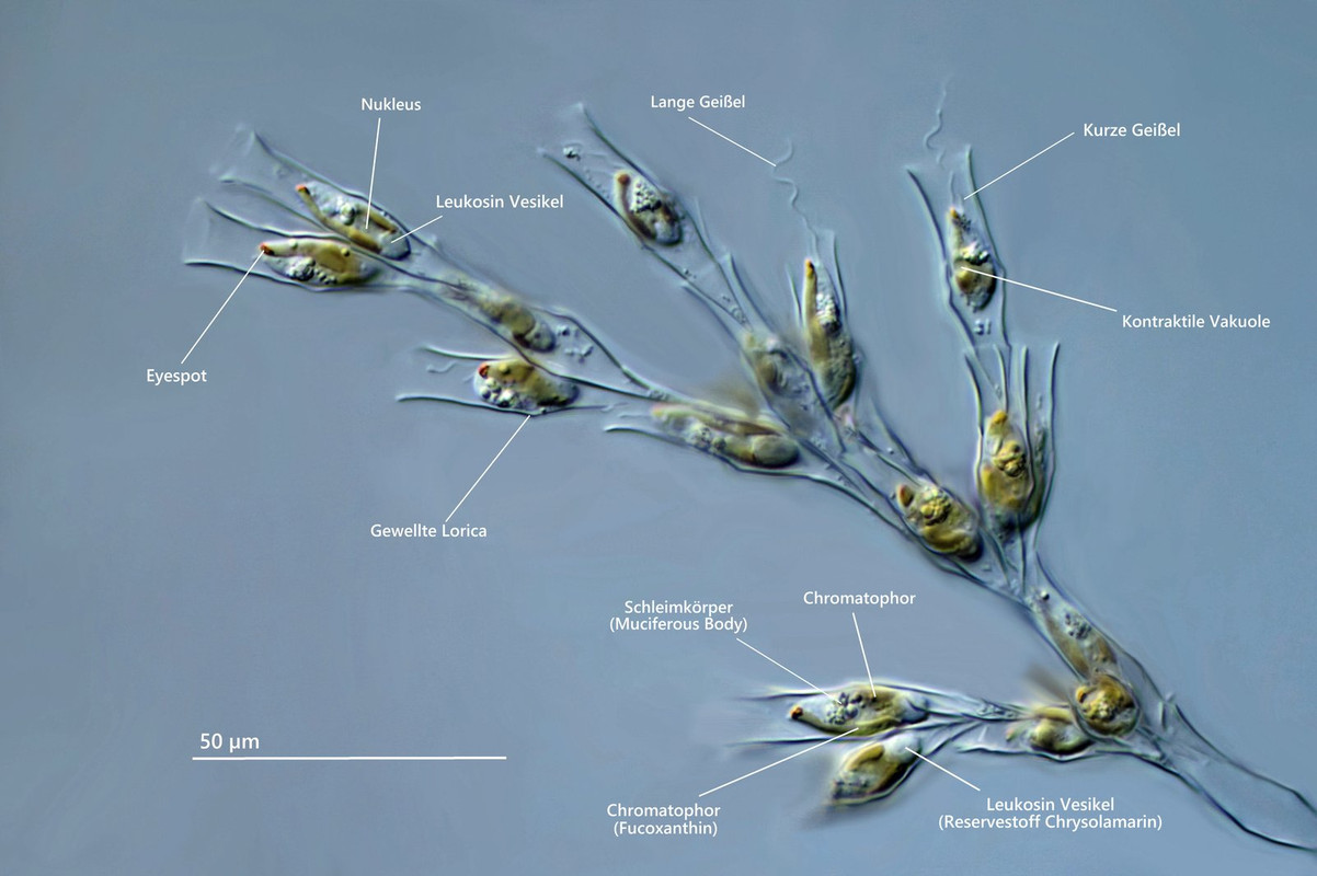 Dinobryon 17 divergens Becherbäumchen Beschriftung DIK 100