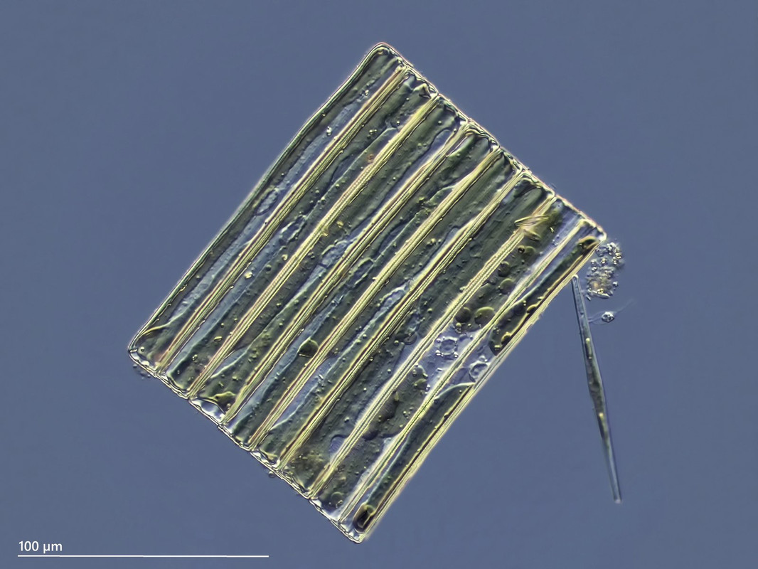 Fragilaria 10 (ev) capucina Bruch-Alge GA DIK 40 Stack 10