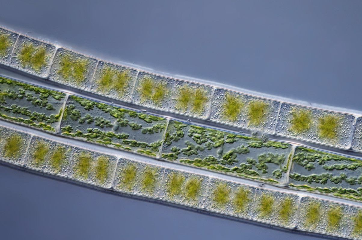 Zygnema 11 sp Sternalge Spirogyra sp Schraubenalge Chloroplast DIK 50 Stack 4 Quelltümpel Bocksleite