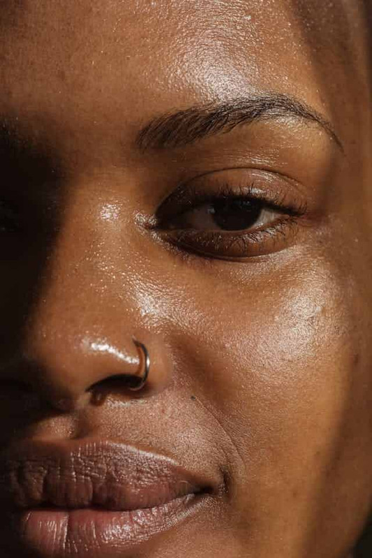 A woman with oily skin and weakened skin barrier