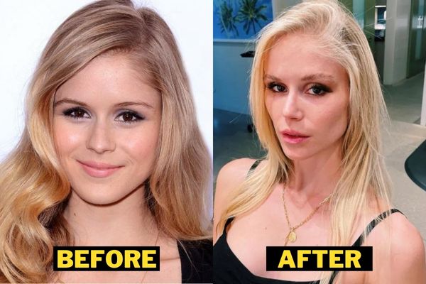 Erin-Moriarty-Before-After-Plastic-Surgery-Photo.jpg