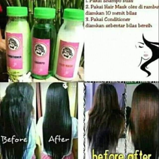 Kuntze Obat Pelurus Rambut Keriting Obat Pelurus Rambut Tampa Catok Obat Pelurus Rambut Permanen Pria Wanita Obat Pelurus Rambut Alami Shampo Obat Pelurus Rambut Permanen Lazada Indonesia