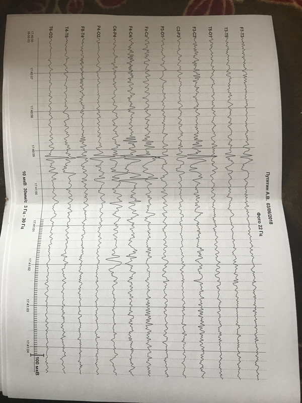 364A2BF0-11AC-4ABD-B9A8-AB319664F823