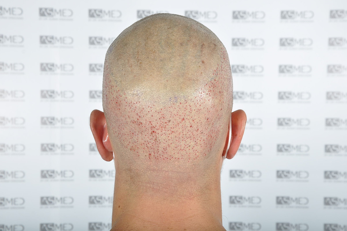 22 O2