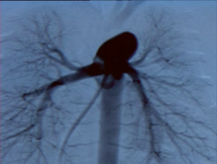 [Image: lo01iyx9zcz6.png]