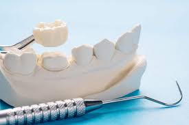 Dental Crown Procedure
