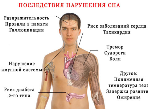 Как уснуть, если не спится – практические рекомендации специалистов