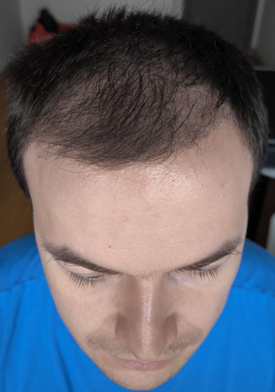 2025-03-26 09-48-52_1742978841634