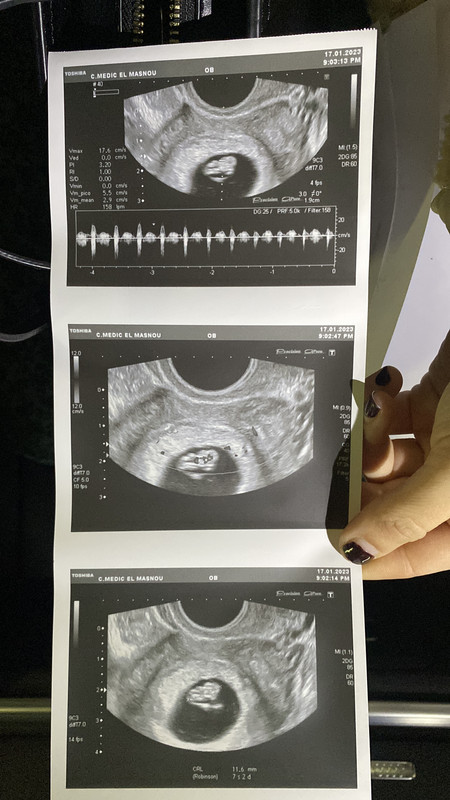 4698D5D4-EA68-4174-AC75-D1EB2A0E0A67