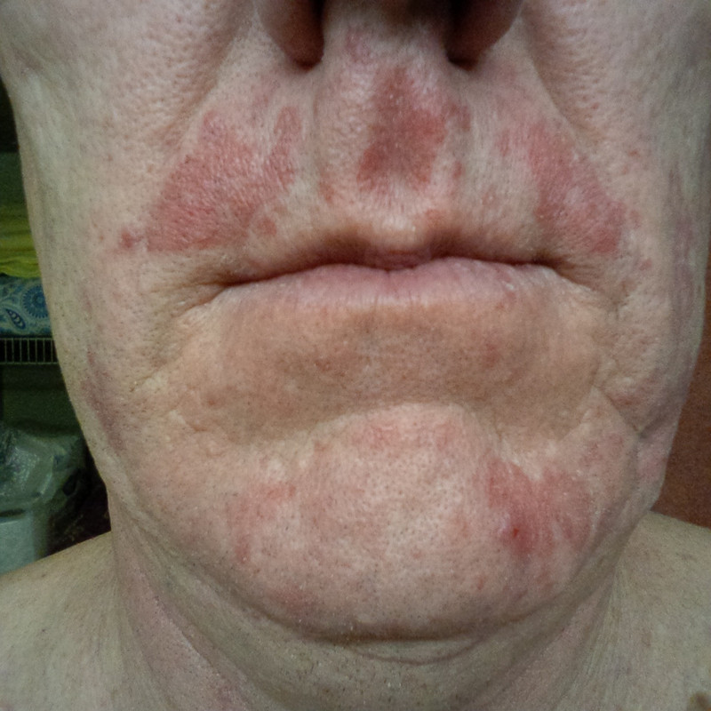 987F4C7F-D63B-435B-880D-77E165B20FFD