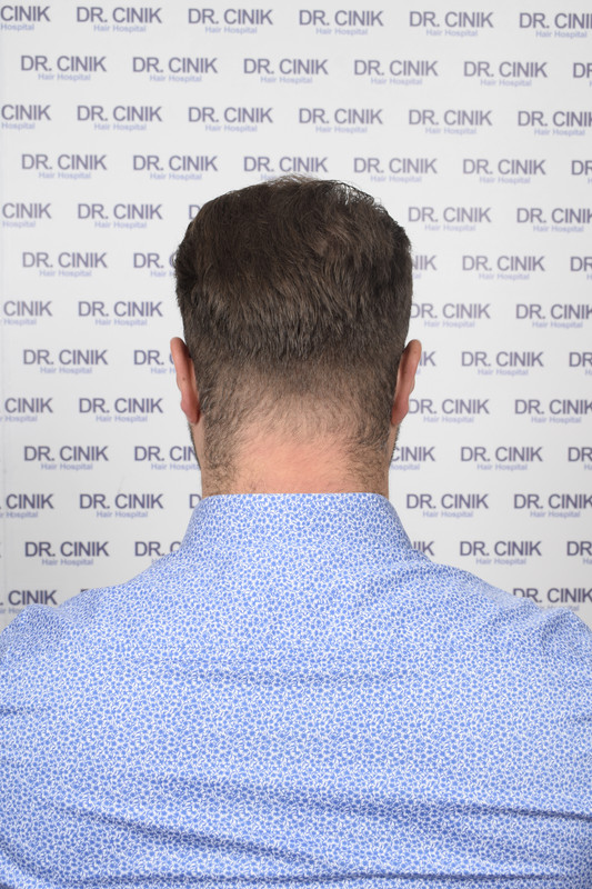 photos préopératoires