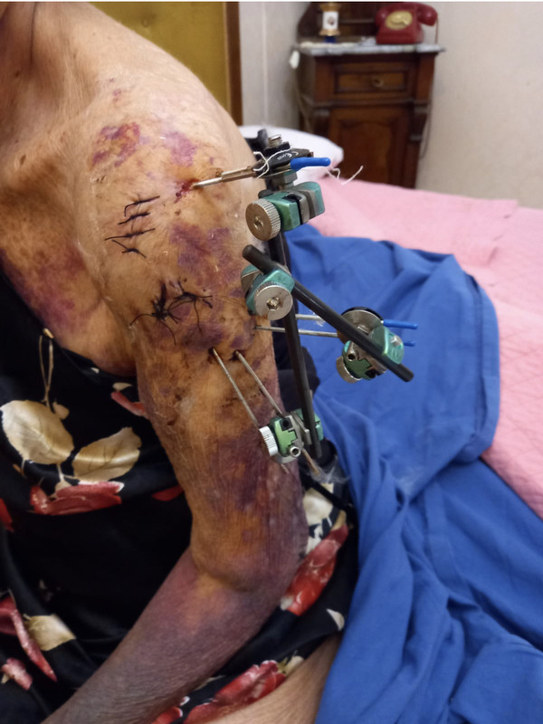 07E9229B-7E6D-470F-8520-05E0B87C5AAE