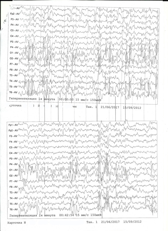 сканирование0005
