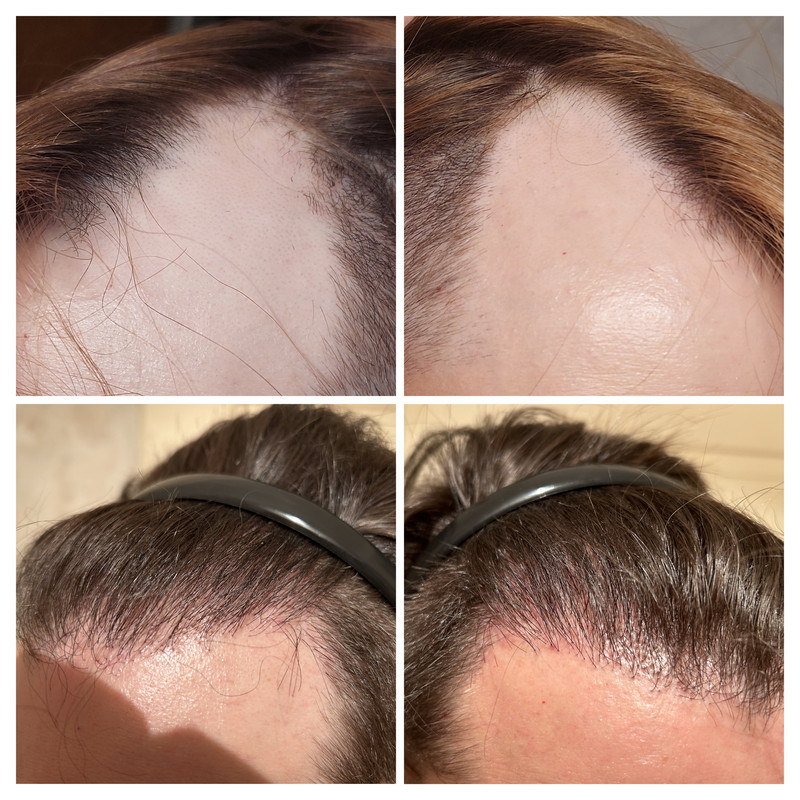 DF79BDAD-0188-4532-A68C-9E018F2C3A17-COLLAGE