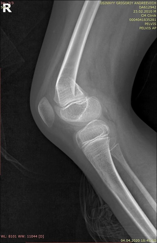 989E2879-327F-428B-A4B9-6401DE9EBDC2