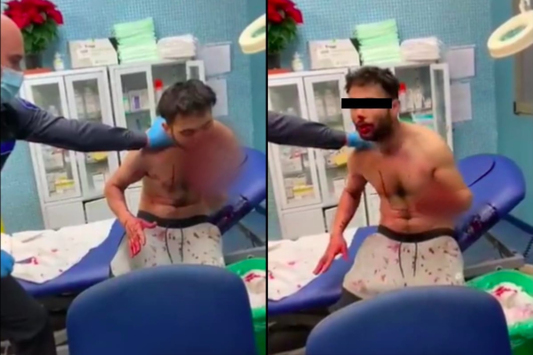 Hombre se come a sí mismo tras consumir droga caníbal en España