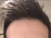 6. marzo 2020. Potete notare come stava decisamente meglio il front. A pochi mesi dlla ripresa di Fi