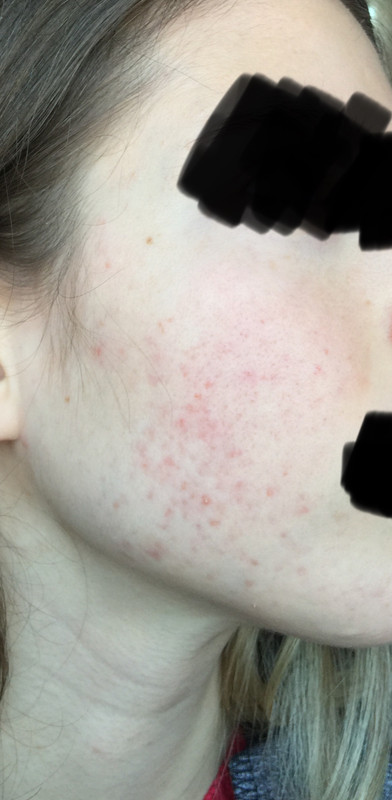 16A92107-0528-4B38-A315-075081B3C85F