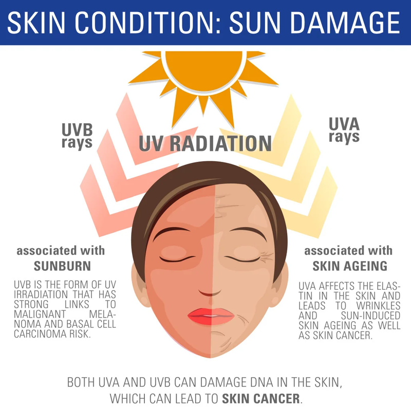 sundamage