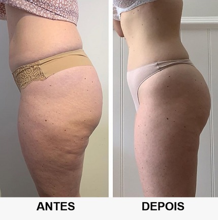 Projeto 11