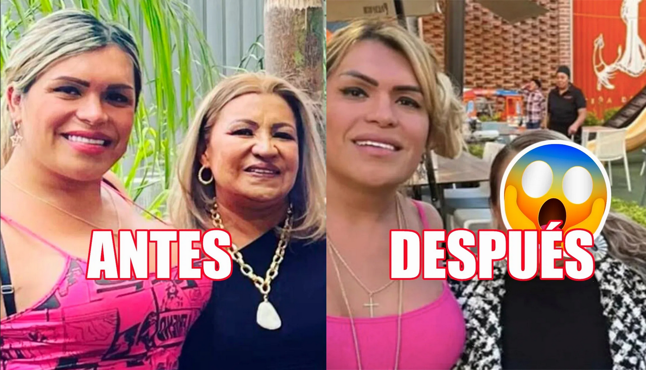 Mamá de Wendy Guevara reaparece irreconocible tras supuesta cirugía en la nariz