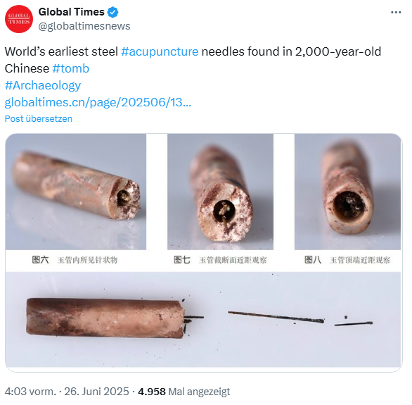 Akkupunktur-Nadeln aus China