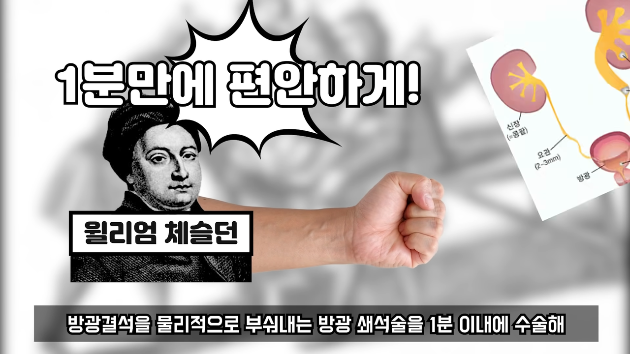 마취제 없이 어떻게 수술했을까_／사망률 300%의 수술_ 9-9 screenshot