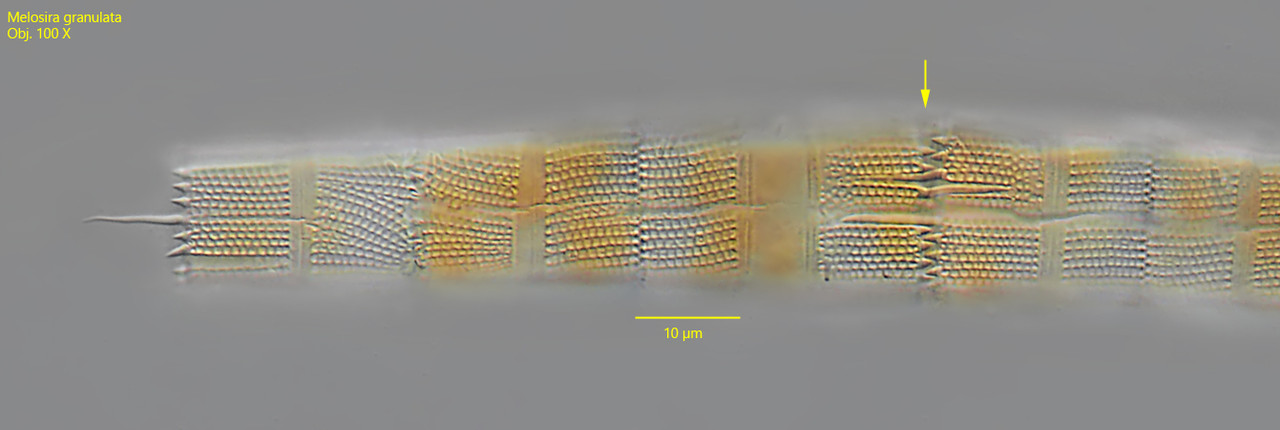 Melosiragranulata-P5013566-Kopie