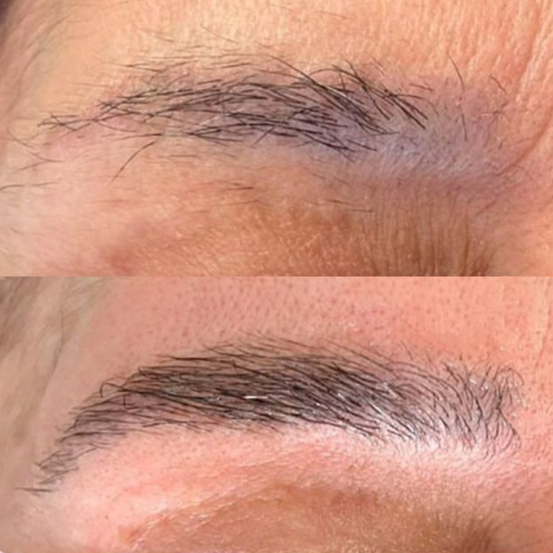 Micropigmentação de Sobrancelhas
