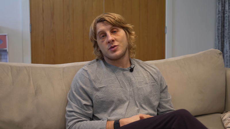 Пади Пимблет: Очната ми ябълка беше докосната от ноктите на Гейджи