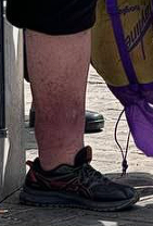 D-nerbein.png