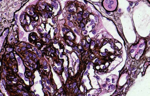 Urology question 6 image