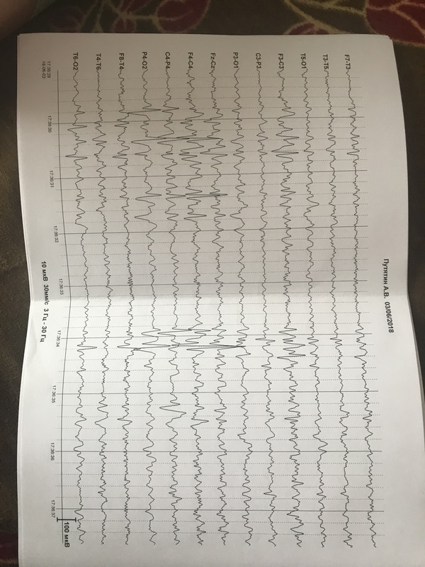 0C2D50DA-907F-4864-AC5C-D4322C5F891D