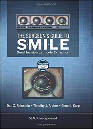 The Surgeon's Guide to SMILE: Small Incision Lenticule Extraction The Surgeon's Guide to SMILE: Small Incision Lenticule Extraction