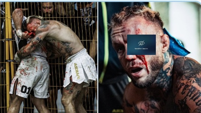 Бивш боец на KSW едва не остана без око в бой без правила за KOTS