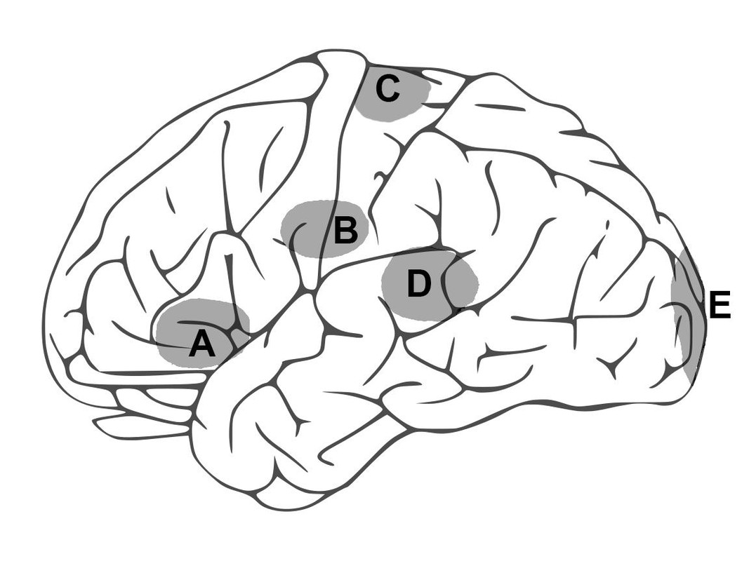Neurology question 1 image