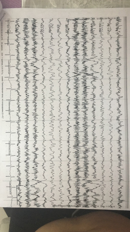 D3FFFA5D-DD71-4C0C-B2F8-BF5EA79C4620