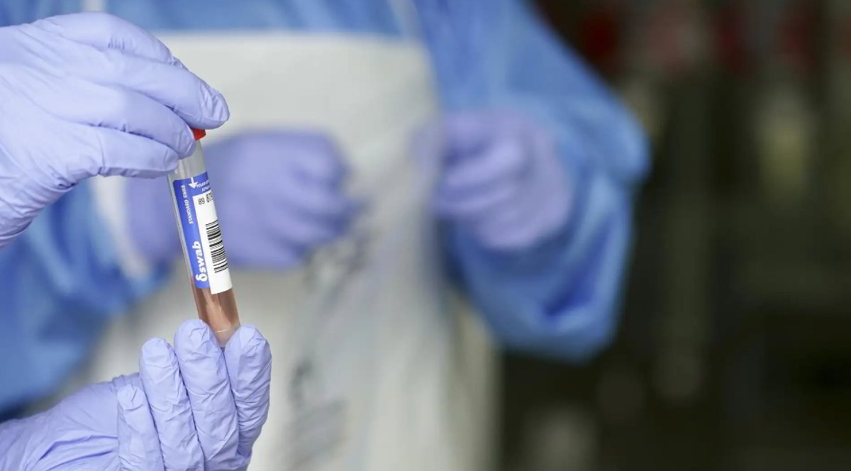 COVID: le persone vaccinate possono trasmettere facilmente la Variante Delta