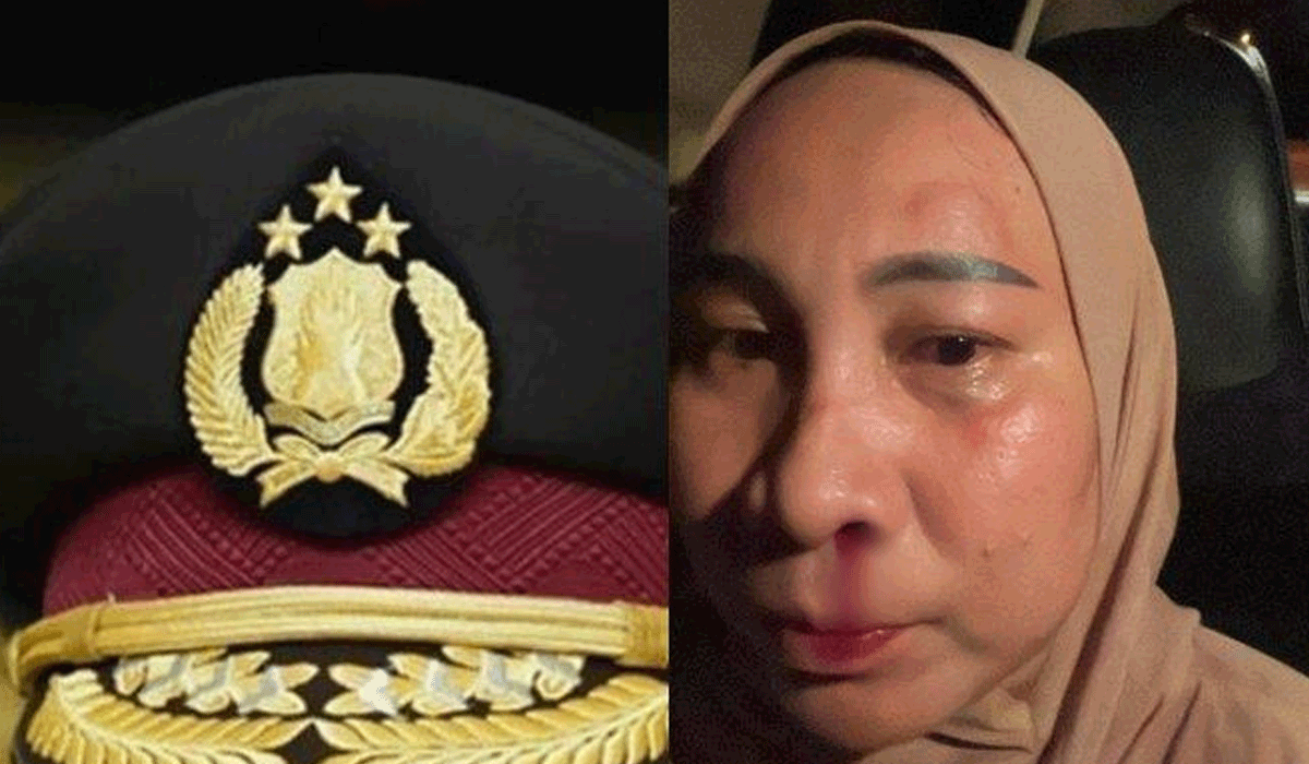 Oknum Perwira Polres Minahasa Utara Dinonjobkan Usai Diduga Aniaya Istri