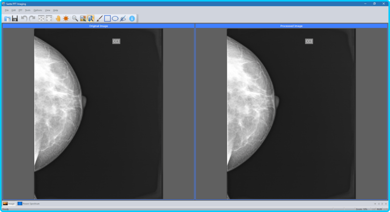 Sante-FFT-Imaging-1-4-0.png
