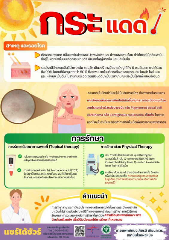 กระแดด
