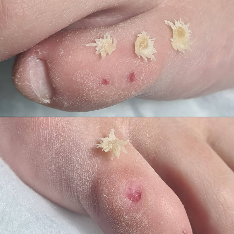 подология 10