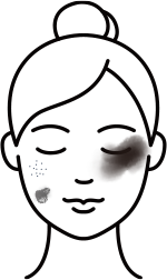 난치성 색소질환