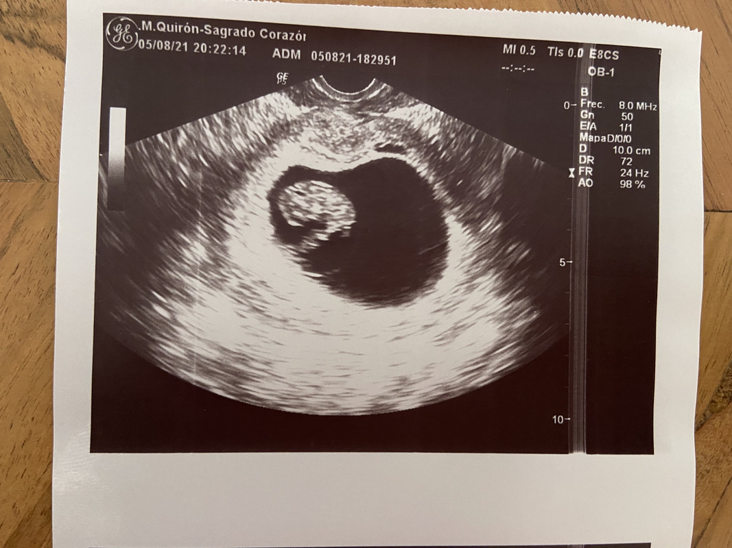 A84B1A4F-3675-440D-B99E-35D23EFAE42F