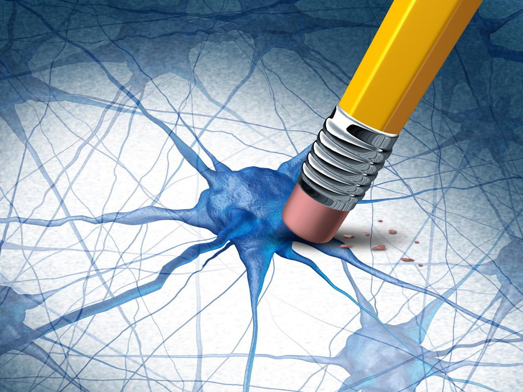 Alzheimer: Cosa causa la rapida morte delle cellule cerebrali e la demenza