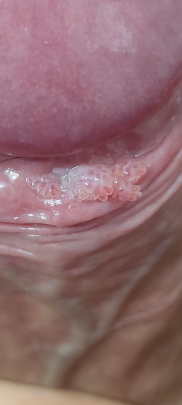 Screenshot 2026 01 24 10 08 24 400 com miui gallery