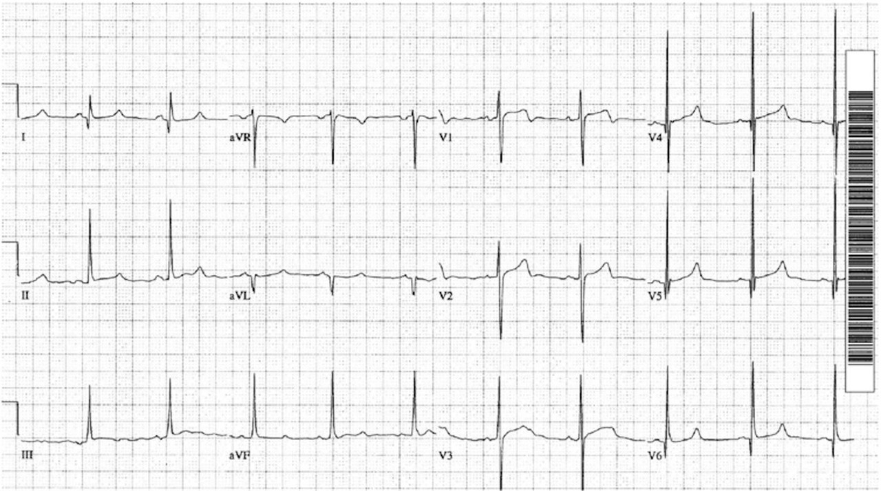 Cardiology question 2 image